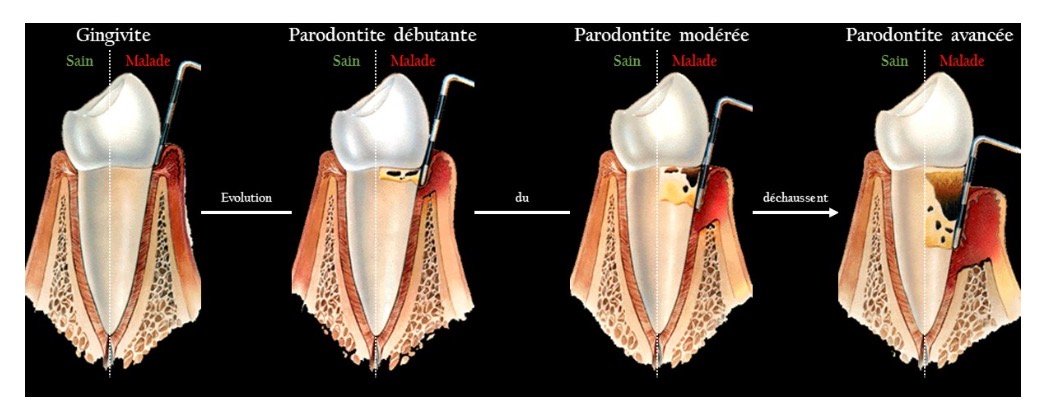 Parodontologie